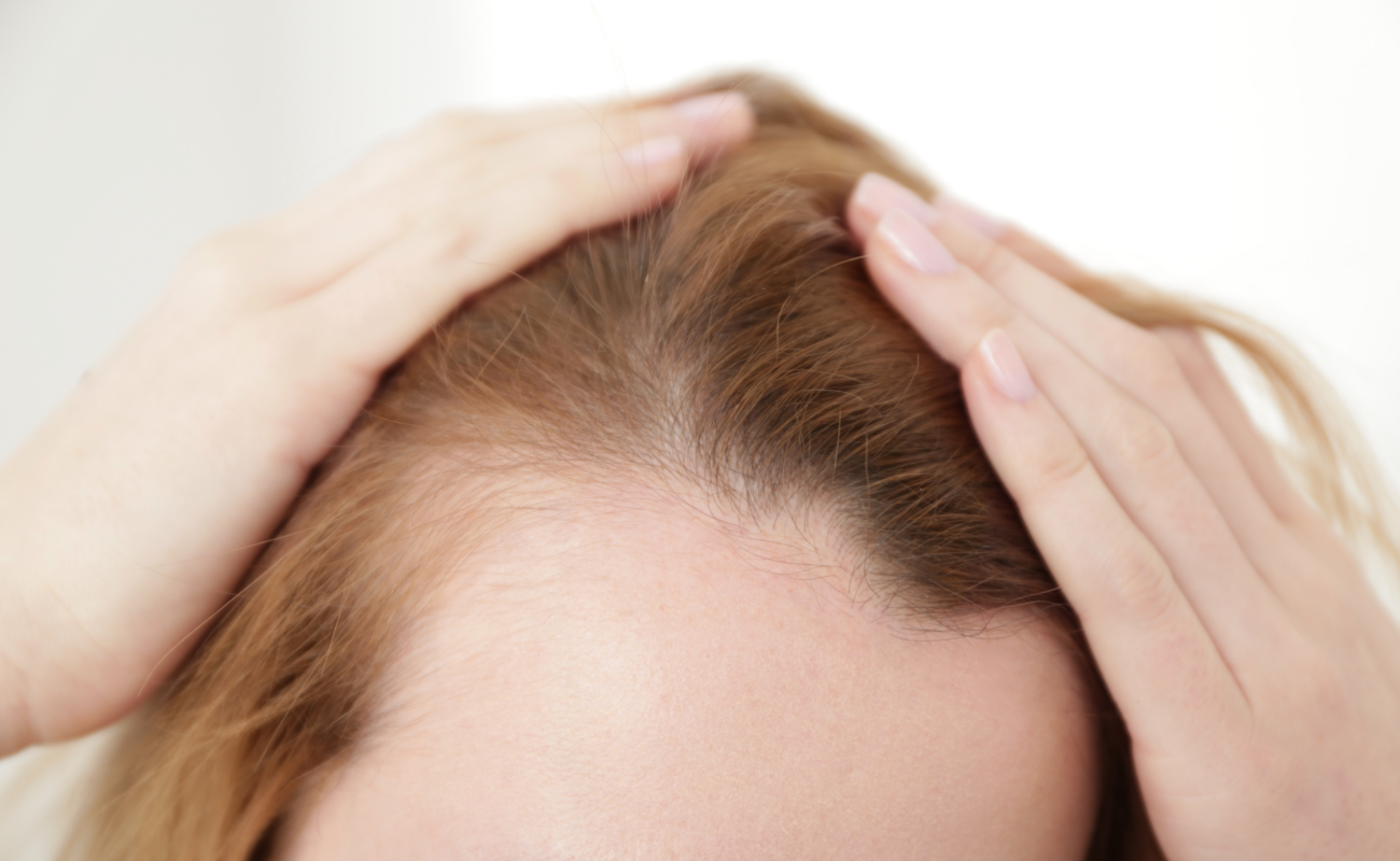 Haarausfall, Haarwachstum, Pflege mit Rizinusöl